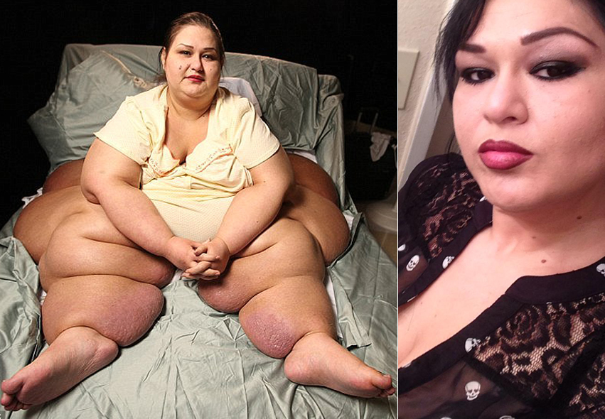 Mayra Rosales antes e depois de perder peso: um drama com final feliz