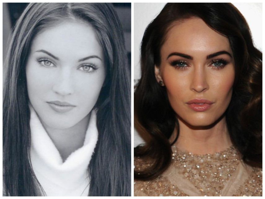 Megan Fox já teria feito bichectomia para mudar o contorno da face