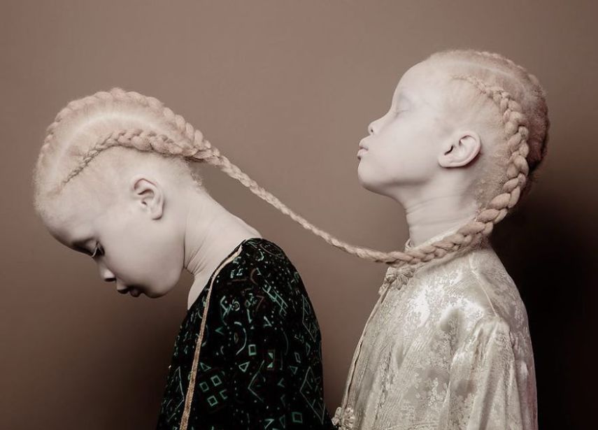 Gêmeos albinos em 'Flores Raras'