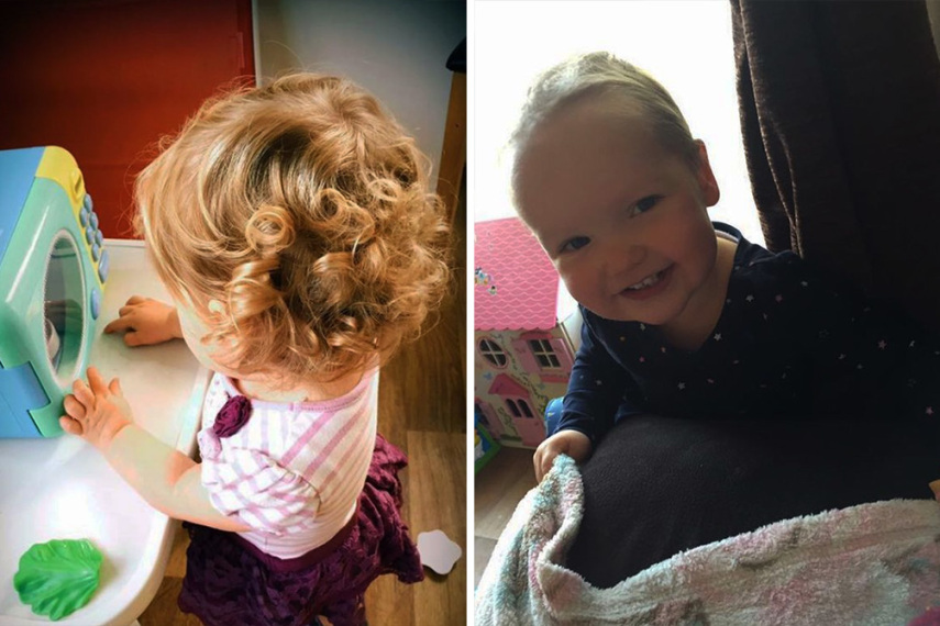 Mãe raspa a cabeça de filha de dois anos para acabar com seu impulso de arrancar os cabelos
