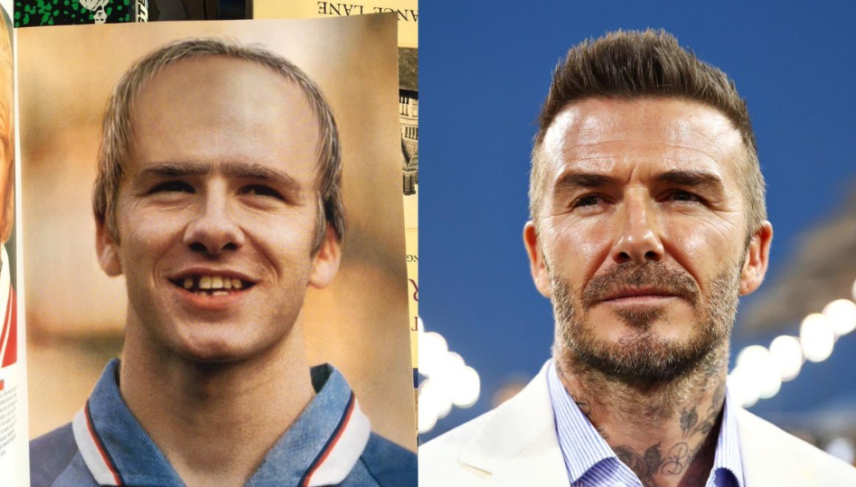 Calvo E Sem Dentes Previs O De Como Seria Beckham Em Vira Piada