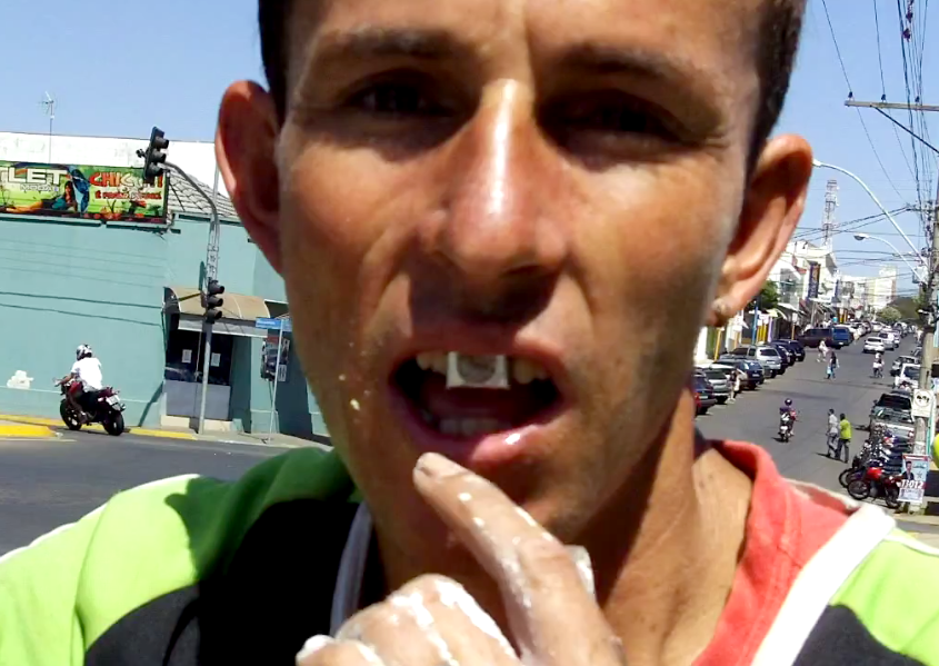 Homem faz a melhor gambiarra dentária de todos os tempos