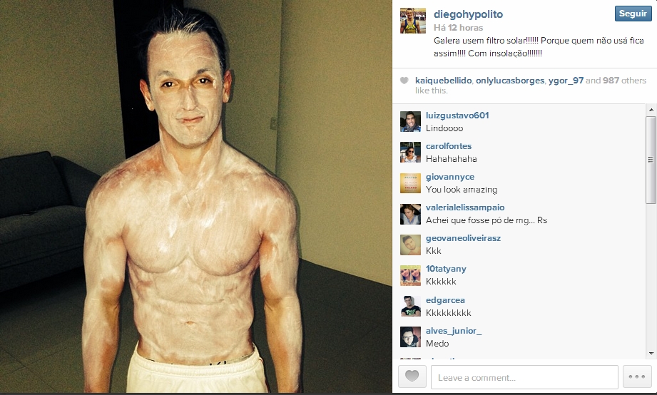 ‘Com insolação’, Diego Hypolito posta foto coberto com filtro solar no Instagram