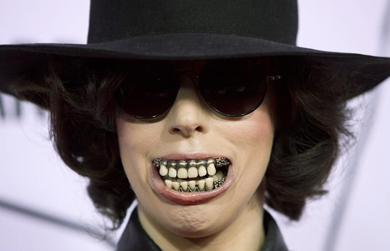 Dentadura de Lady Gaga no YouTube Music Awards era, na verdade, um bracelete