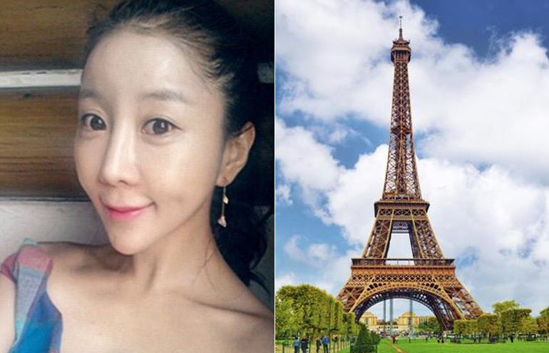 Chinesas fazem plástica para deixar nariz em formato da Torre Eiffel