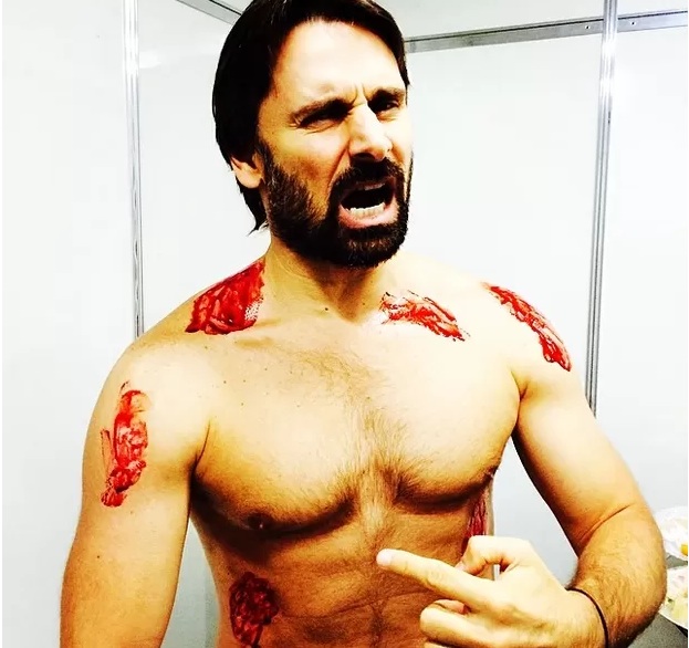 Murilo Rosa posta foto todo ensanguentado