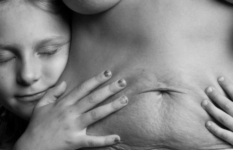 Série fotográfica mostra as marcas da maternidade nas mulheres