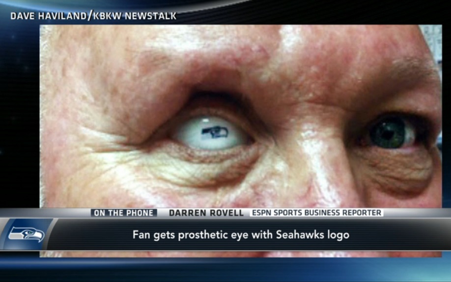 Fã de NFL, torcedor do Seahawks usa prótese ocular com o emblema da franquia