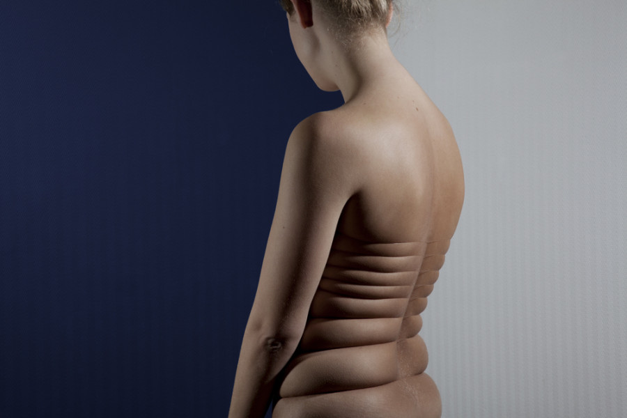 Na série fotográfica, Juuke Schoorl quer explorar a flexibilidade e adaptabilidade da pele humana
