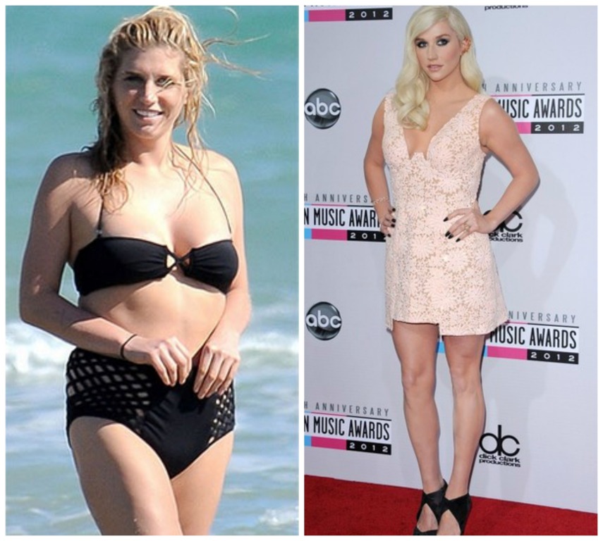 A cantora Kesha é outra que sofreu de anorexia e bulimia, tendo ate cancelado a sua turnê em 2014 para cuidar da saúde. 