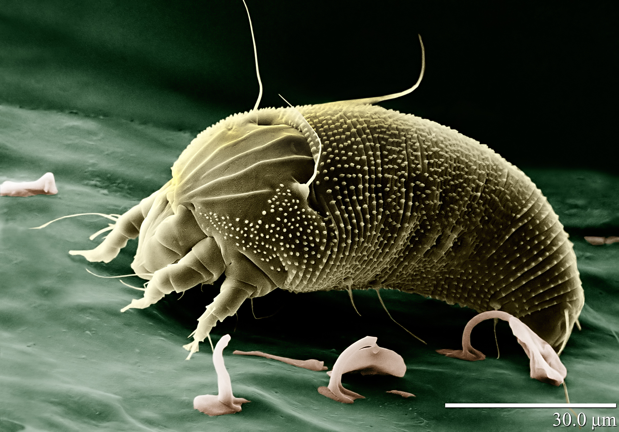 Já o menos artrópode é um bichinho bem filho da mãe que todos nós aprendemos a odiar desde o momento em que nascemos: o ácaro (Aceria anthocoptes).
Esse maldito animal que causa alergia em 11 a cada 10 pessoas do mundo habita nossas camas, sofás e qualquer outro lugar em que você queira descansar.
A medida mínima de um ácaro adulto é de 0,25 mm, o necessário para tornar a vida de um alérgico um inferno.