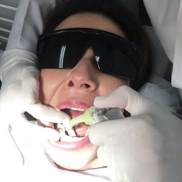 Mais uma de dentista, para conscientizar a galera