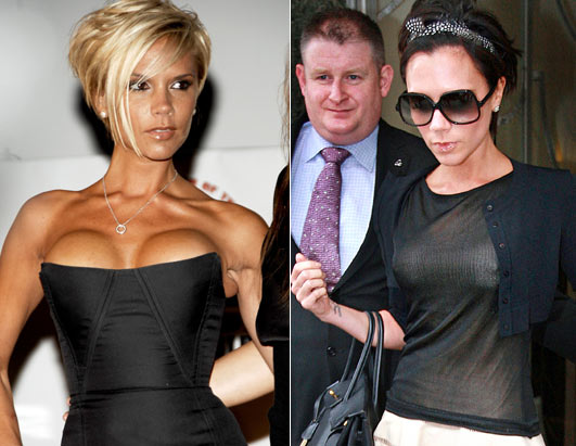 TURBINADA! A ex-Spice Girl teria colocado seu primeiro implante de silicone em 1999. Insatisfeita porém com o resultado, a mulher de David Beckham resolveu colocar protéses maiores em 2000. Em 2011, admitiu ter retirado as próteses para ter um visual mais natural. Será?