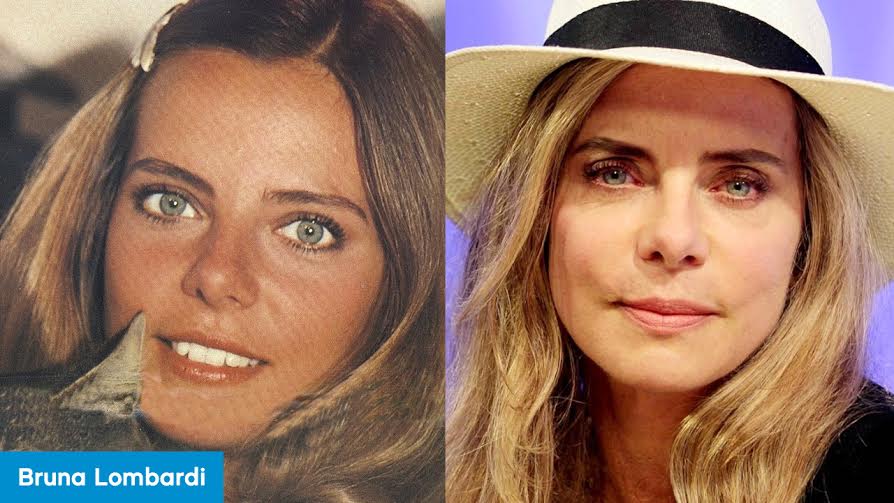 Essa deusa de 62 anos admite que já fez uma cirurgia plástica para retirar o excesso de pele nas pálpebras e já aplicou botox. Dentre os cuidados de beleza ela garante que uma boa alimentação, cremes com vitamina C, e boas doses de pílulas de cálcio e vitaminas fazem milagres! Anotado, Bruna!