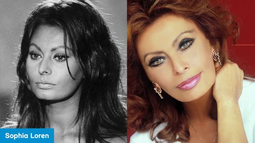 Sophia Loren já afirmou que, no início de sua carreira, lhe disseram que ela precisaria fazer uma cirurgia plástica para “corrigir” a boca e o nariz. Apesar da pressão, porém, a atriz se manteve firme na recusa. Não dá pra ter certeza se ela não fez nenhuma intervenção cirúrgica ao longo da vida, mas é fato que ela chegou belamente aos 80 com o traços dignos e bem similares de quando era jovenzinha. A atriz diz que um dos grandes segredos é ser feliz e nunca dormir maquiada. Arrasou, Sophis!