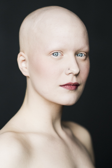 A fotógrafa Sigga Ella registrou sete mulheres com Alopecia a fim de conscientizar sofre a doença