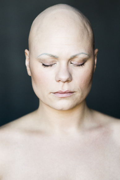 A fotógrafa Sigga Ella registrou sete mulheres com Alopecia a fim de conscientizar sofre a doença