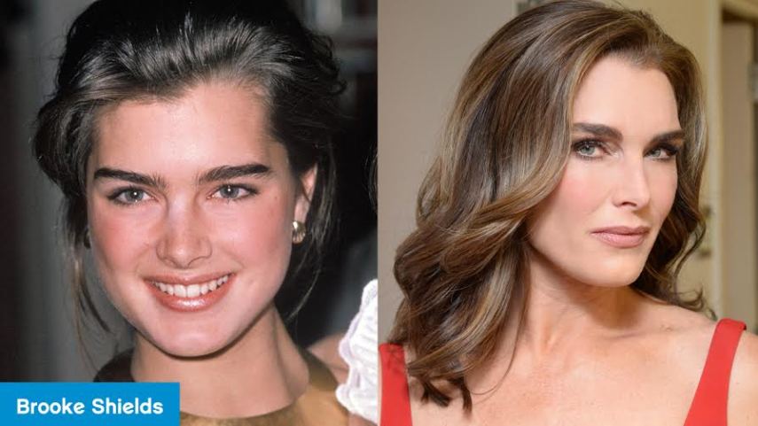 A modelo e atriz está lynda nos com seus 50 anos. O principal segredo de beleza, segundo ela, está em saber deixar o tempo passar. Seu rosto é natural, sem aquela aparência plastificada típica dos excessos em procedimentos estéticos. Ela fez apenas um preenchimento nas marcas de expressão e não cogita repetir o feito tão cedo. “Quem sabe daqui uns 10 anos”, diz. Enquanto isso, ela se trata usando bons produtos.