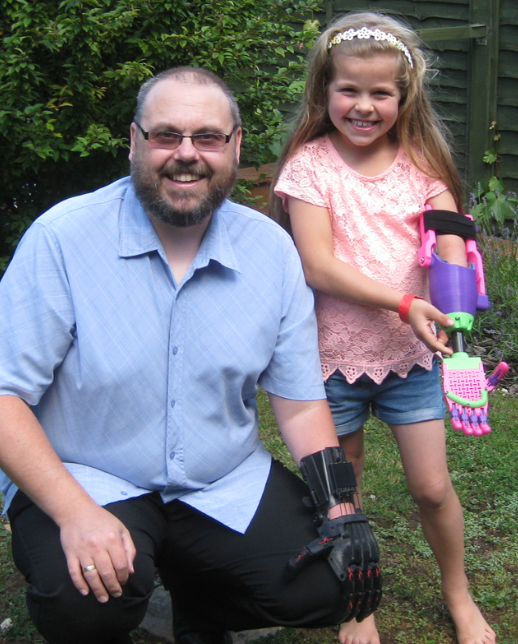 Isabella, de 8 anos, recebeu um braço biônico de presente, e sua reação foi a mais fofa possível 