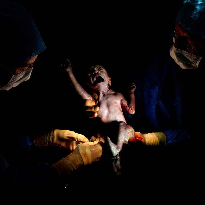 Fotógrafo captura o momento em que bebês começam a respirar fora da barriga da mãe