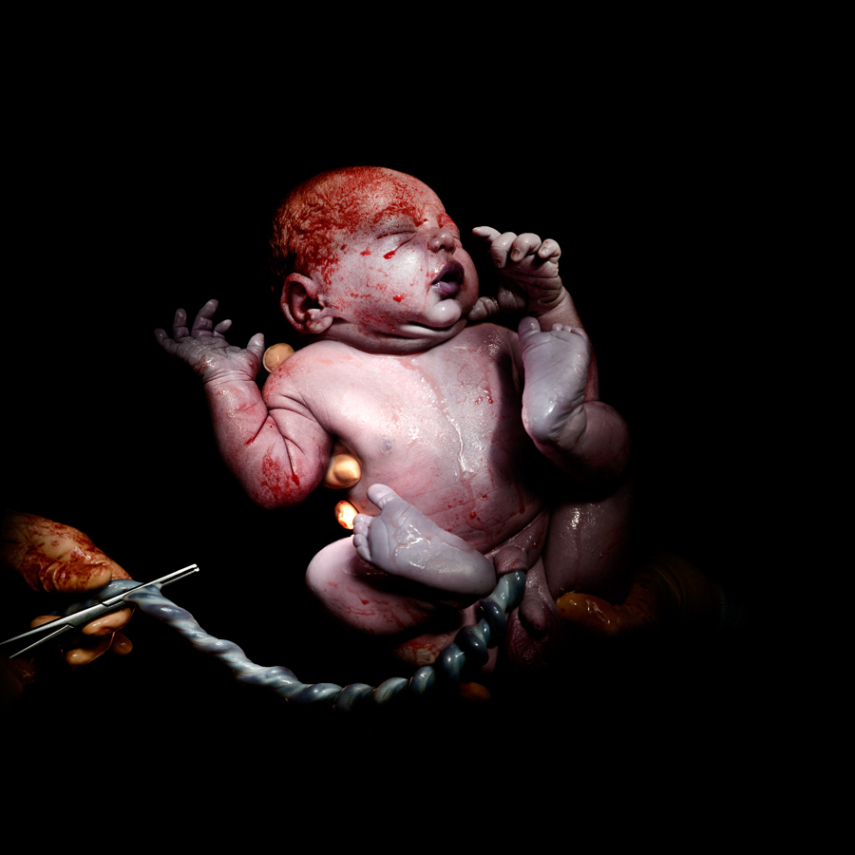 Fotógrafo captura o momento em que bebês começam a respirar fora da barriga da mãe