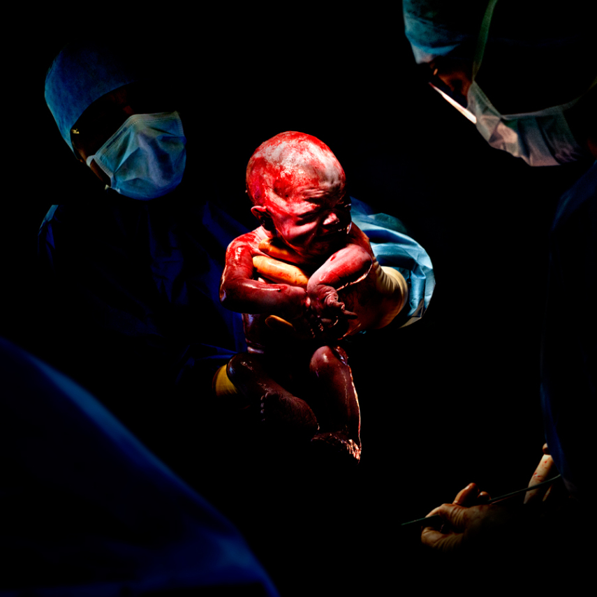 Fotógrafo captura o momento em que bebês começam a respirar fora da barriga da mãe