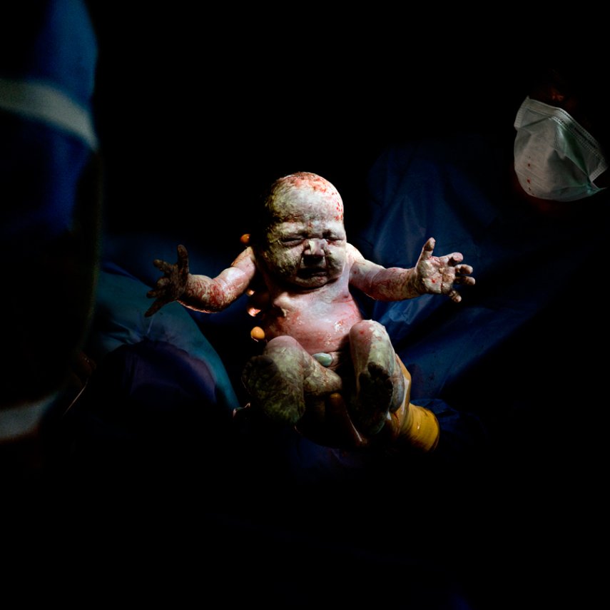Fotógrafo captura o momento em que bebês começam a respirar fora da barriga da mãe
