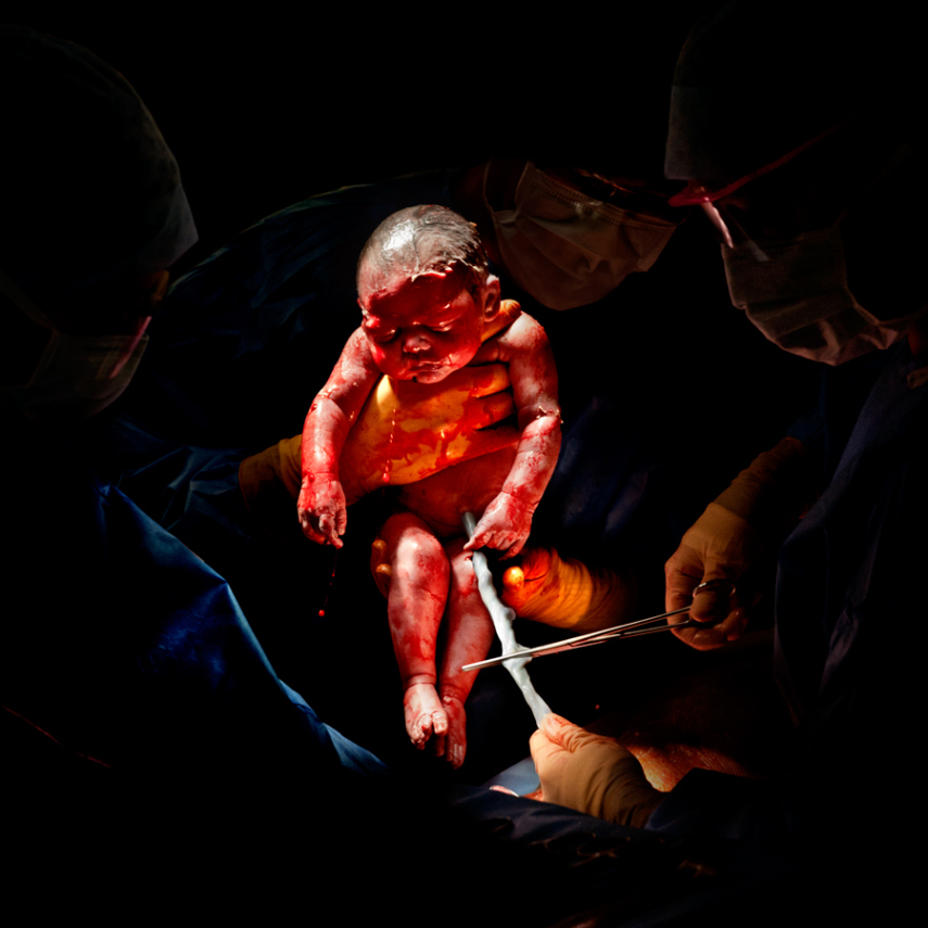 Fotógrafo captura o momento em que bebês começam a respirar fora da barriga da mãe