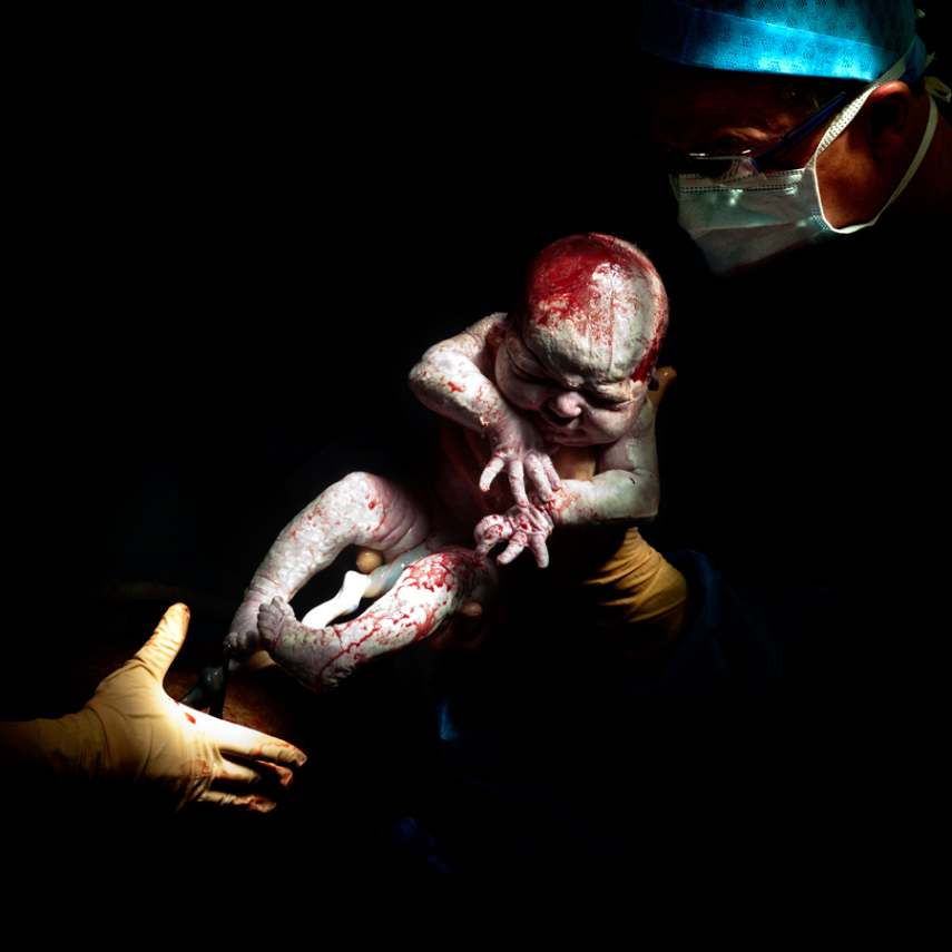 Fotógrafo captura o momento em que bebês começam a respirar fora da barriga da mãe
