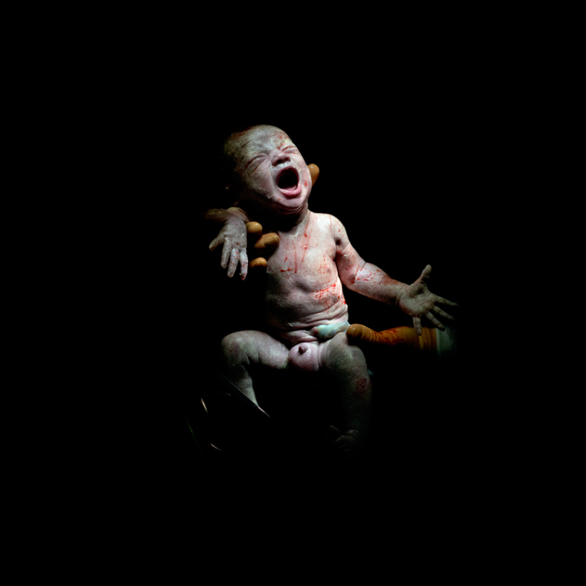 Fotógrafo captura o momento em que bebês começam a respirar fora da barriga da mãe