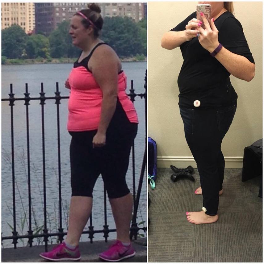 Alissa Kane antes e depois de eliminar os 26 quilos
