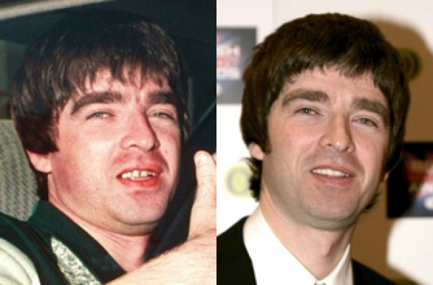 Noel Gallagher