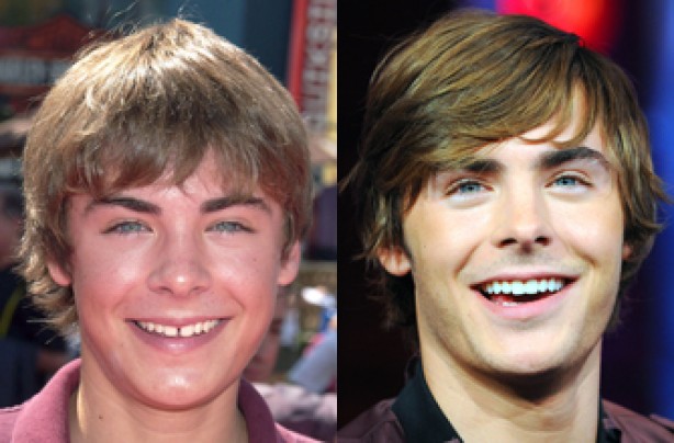 Zac Effron