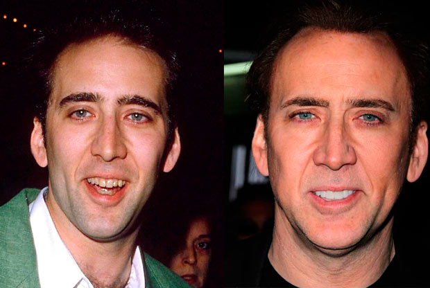 Nicolas Cage