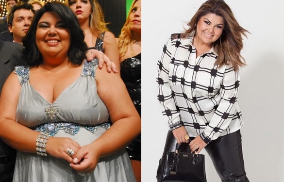 A atriz fez redução de estômago em 2010 e perdeu 20 quilos. Em 2015, Fabiana participou do quadro 'Medida Certa' do Fantástico e conseguiu enxugar mais 10 quilos. 