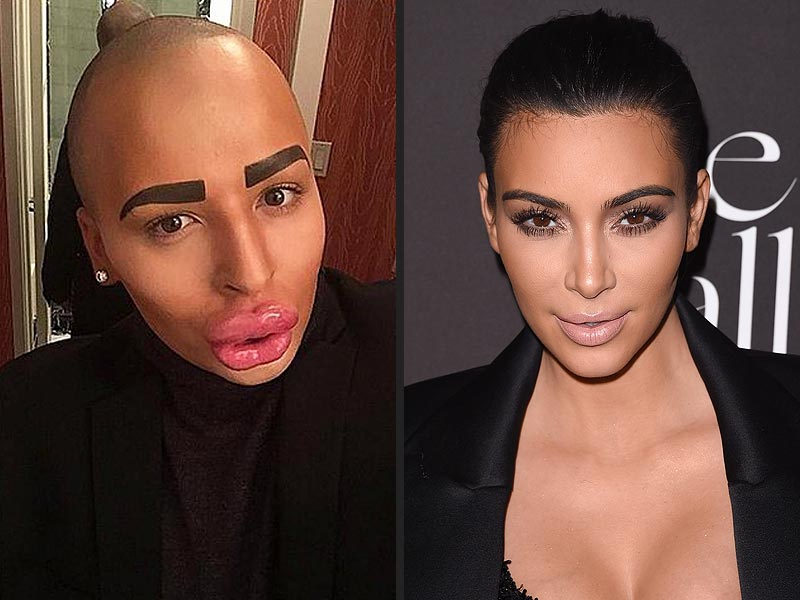 Mais um fã que quis parecer a Kim Kardashian: o britânico Jordan James Parke. O maquiador de 23 anos colocou preenchimento nos lábios e em várias partes do rosto para ficar mais parecido com ela. Segundo ele, tudo custou cerca de R$ 465 mil