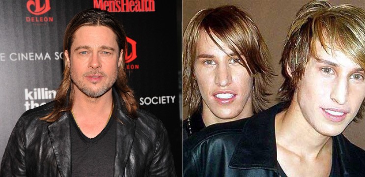 Os gêmeos Mike e Matt participaram de um programa da MTV ‘I Want a Famous Face’ para ficarem parecidos com o ator Brad Pitt. Eles despenderam US$ 25 mil em várias cirurgias, como rinoplastia e implantes no queixo e bochecha