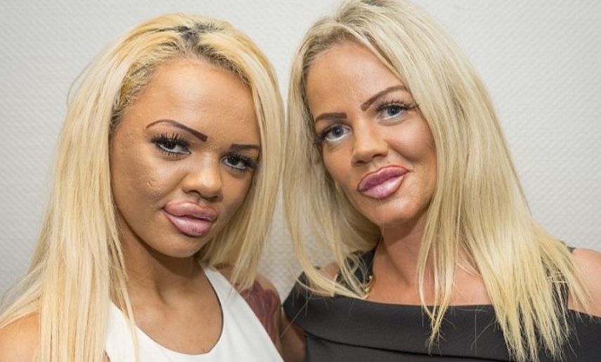 Georgina (39) e Kayla (21), contaram à imprensa britânica que são obcecadas por procedimentos estéticos. A revelação acabou chamando a atenção de um canal de TV, e agora as duas serão vistas em um reality show chamado 'My Mum's Hotter Than Me' (minha mãe é mais sensual do que eu), que vai mostrar a disputa entre elas para ver quem fica mais, digamos, bonita e turbinada.