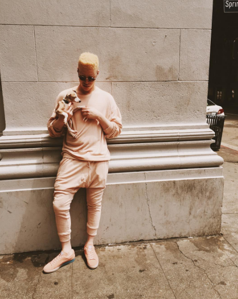 O modelo albino Shaun Ross