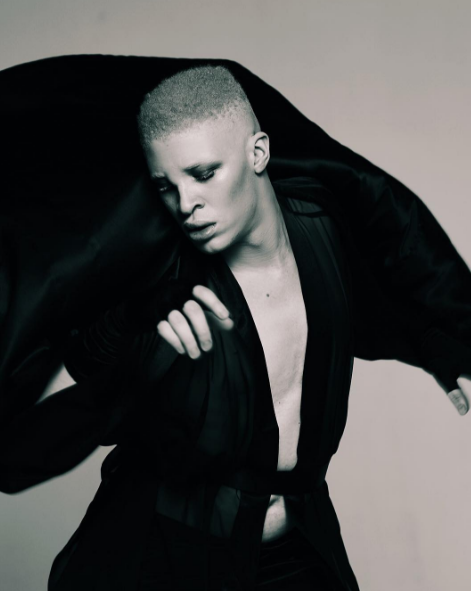 O modelo albino Shaun Ross