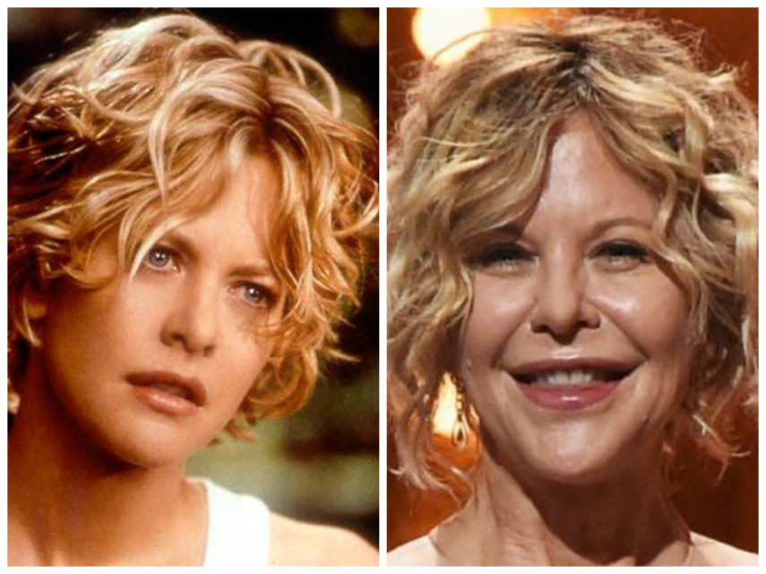 Meg Ryan, musa das comédias românticas, recebeu uma chuva de críticas ao aparecer irreconhecível no Tony Awards nesse ano. Ela nega veementemente ter feito cirurgias plásticas