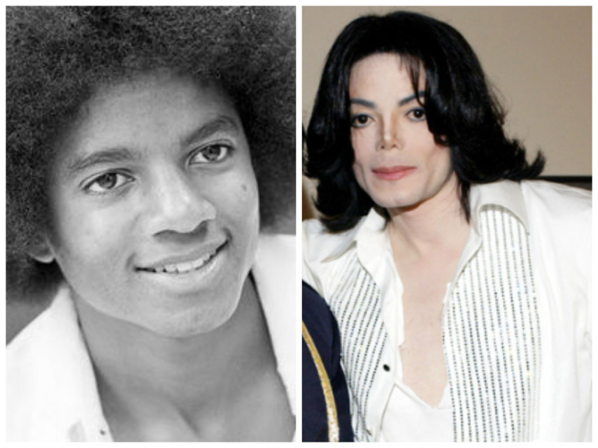 O cantor Michael Jackson, rei do pop, sempre foi alvo da mídia e dos fãs por sua aparência. Ninguém aceitava muito as plásticas, principalmente, as do nariz e da boca