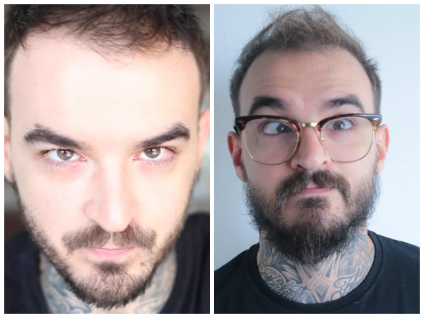 O youtuber PC Siqueira fez uma cirurgia para corrigir o estrabismo. Uma cirurgia estética, mas que tem impacto social e econômico na vida das pessoas, como apontam pesquisas. Muitos fãs de PC criticaram sua decisão de operar e ainda disseram que ele perderia sua graça. Ele mandou um recado maravilhoso para os críticos: “Sinto muito se a graça para você é um defeito de uma outra pessoa, eu só posso lamentar. Agora, ou você vai me achar sem graça de uma vez por todas, ou vai me achar engraçado por outras coisas”