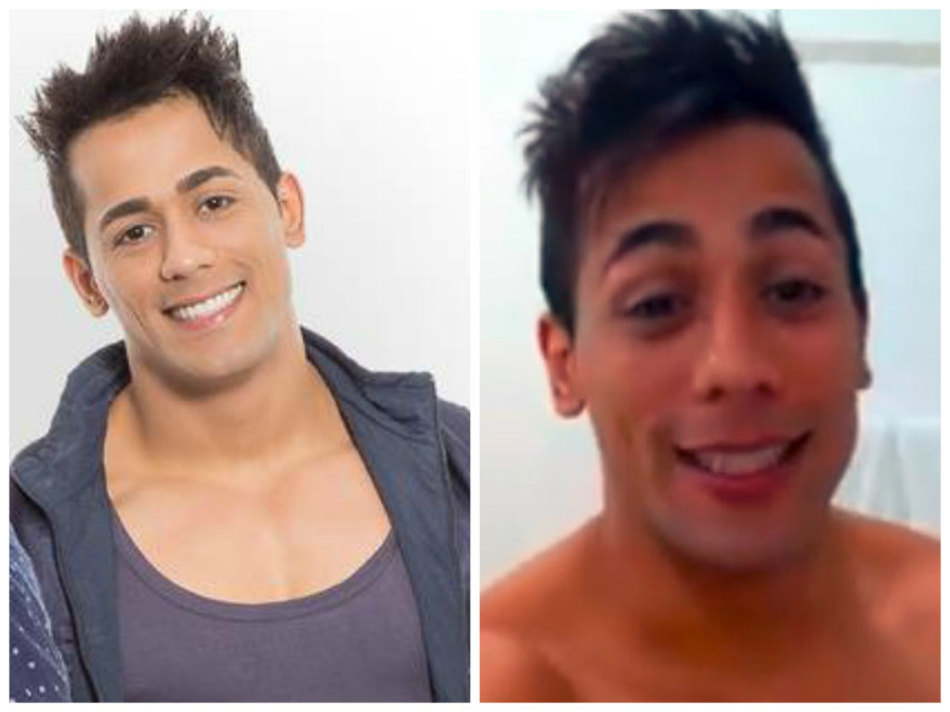 O sertanejo Tiago, dupla de Hugo, voltou aos holofotes em 2015 por um vídeo que gravou, mostrando o quanto se arrependeu de ter feito preenchimento labial. O cantor, que foi vencedor do Fama 3, e o resultado não agradou. Mesmo com o vídeo, os fãs condenaram a nova aparência. Ele mesmo disse que parecia um 