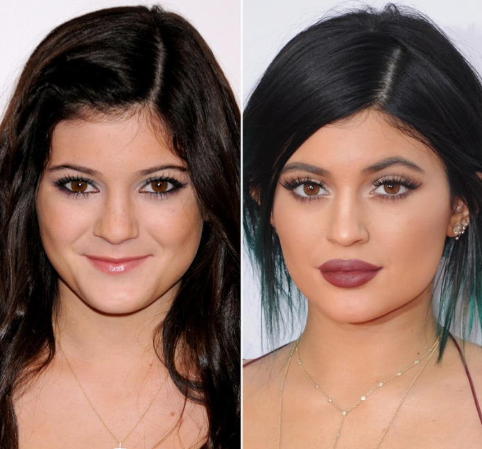 Kylie Jenner