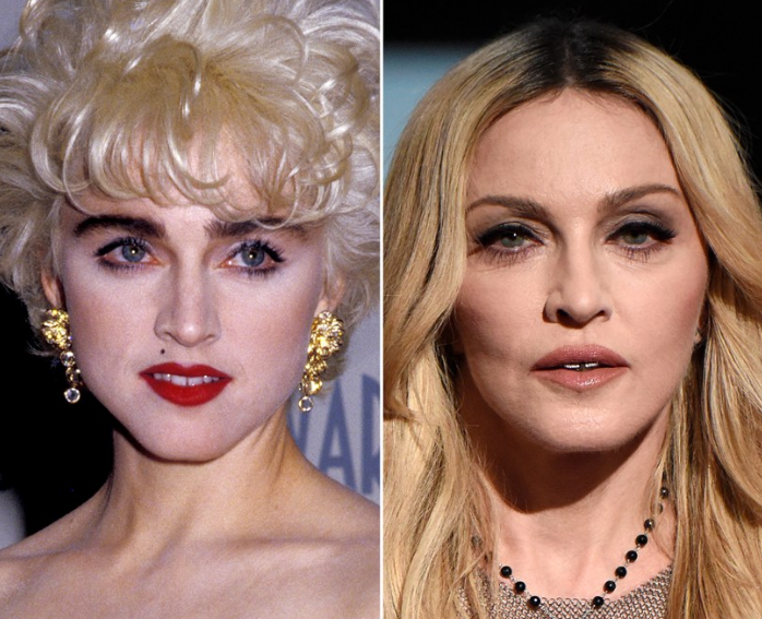 Madonna