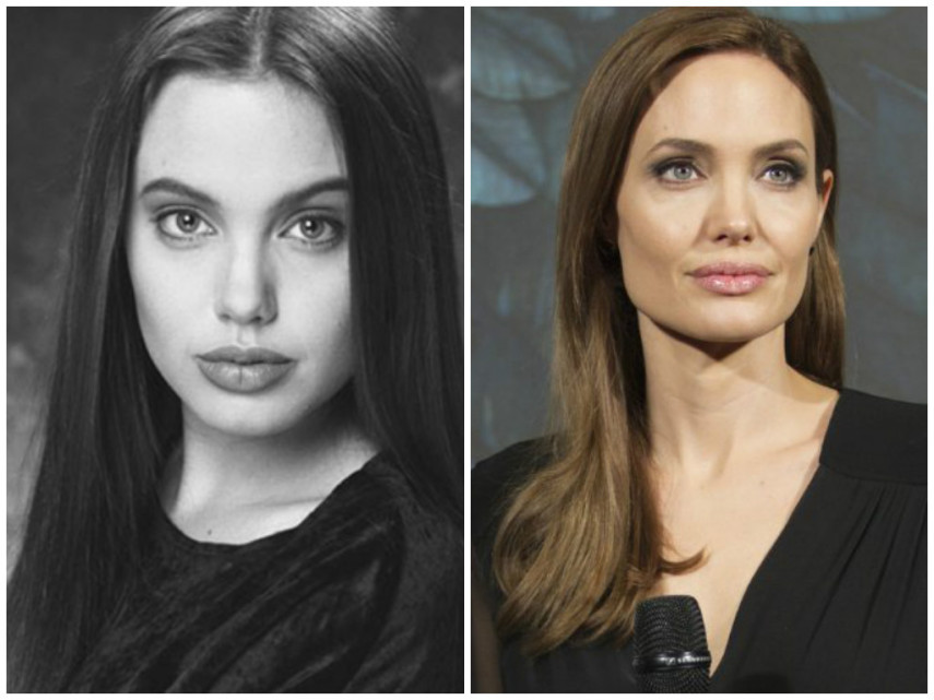 Angelina Jolie já teria feito bichectomia para mudar o contorno da face