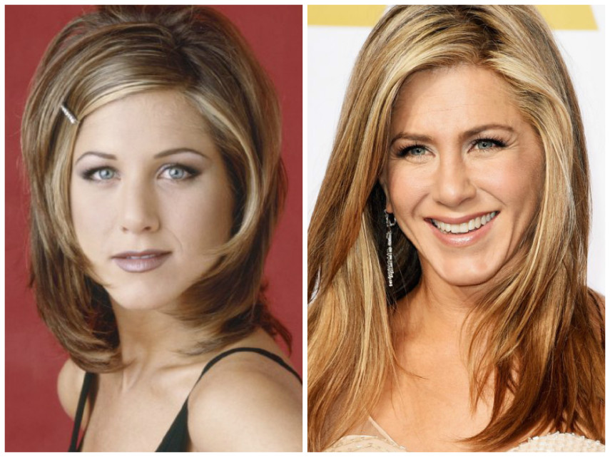 Jennifer Aniston já teria feito bichectomia para mudar o contorno da face