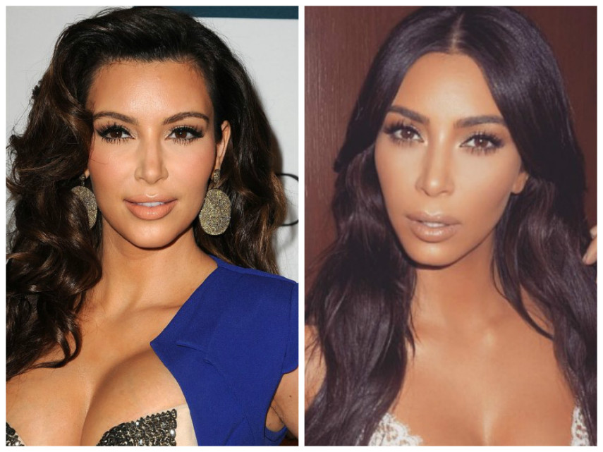 Kim Kardashian já teria feito bichectomia para mudar o contorno da face