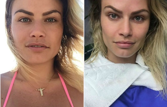 A ex-BBB Natália Casassola já fez bichectomia para mudar o contorno da face